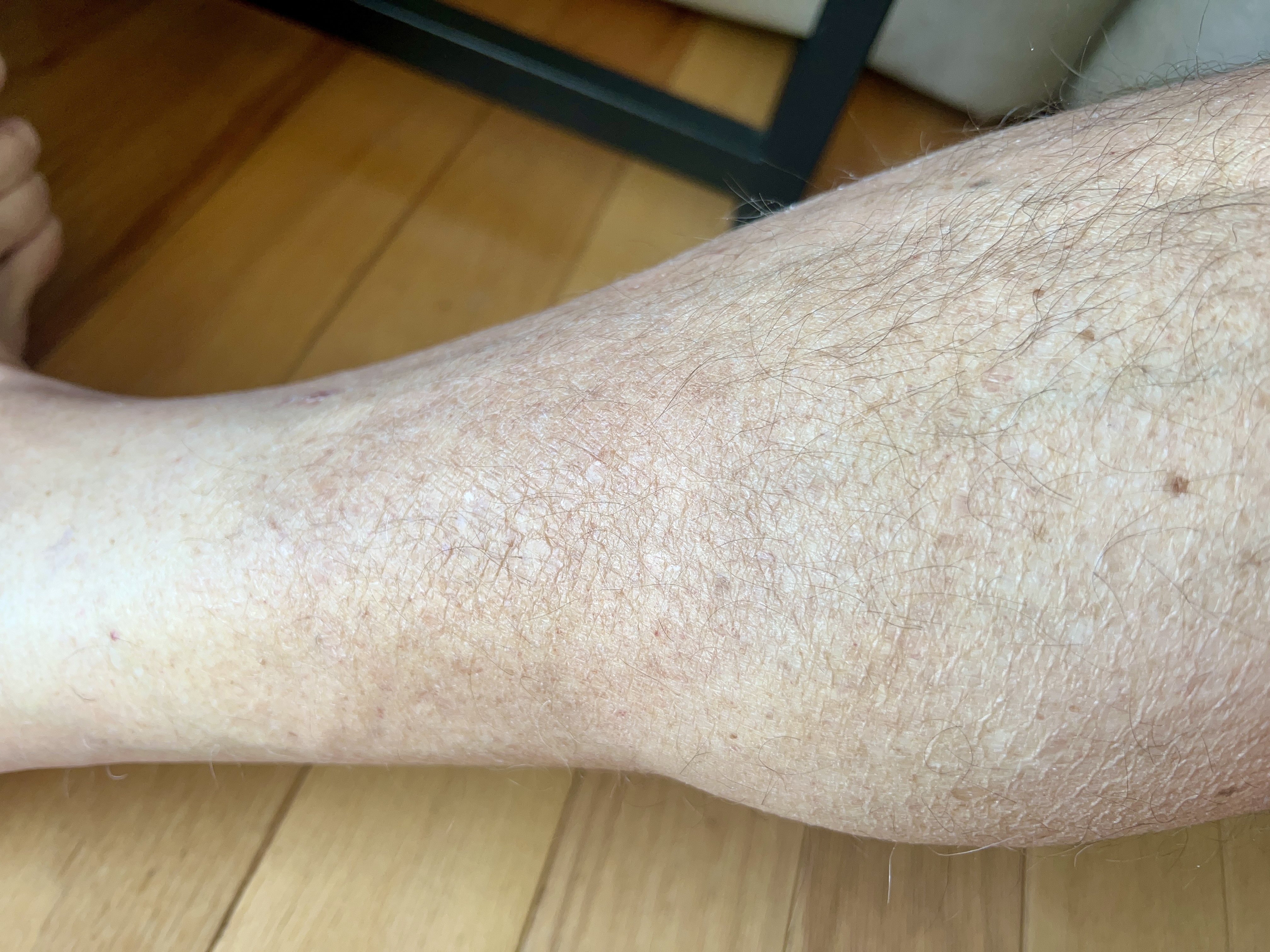 friday morning red rash | barely noticeable